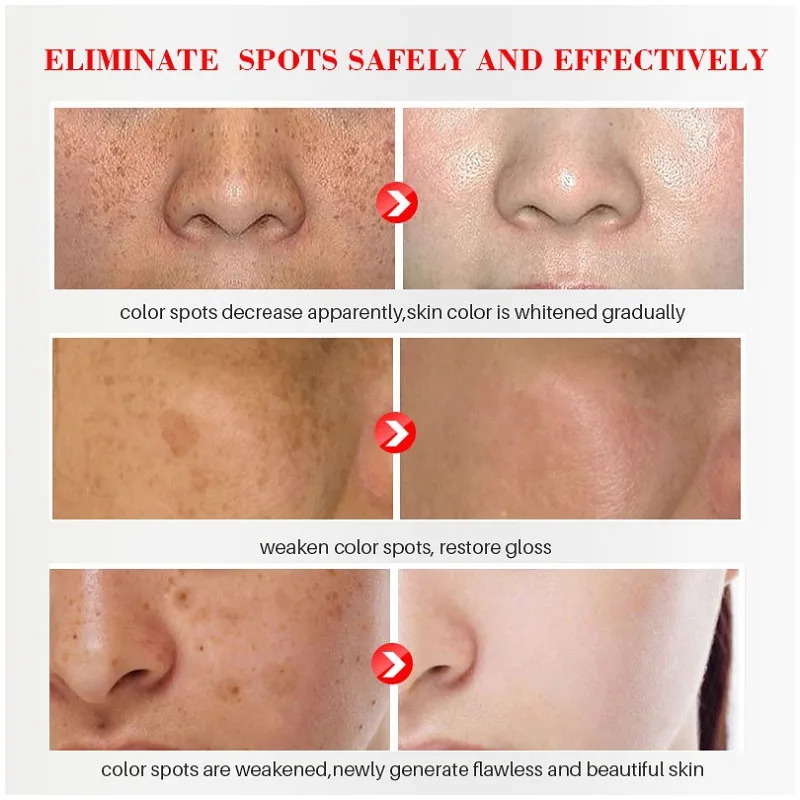 ที่มีประสิทธิภาพWhitening Frec - Licorice Root Sticks บทวิจารณ์และราคา